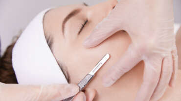 Dermaplaning